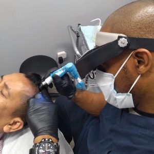 Procedure_1 | KIK Scalp Micropigmentation Design and Treatment
